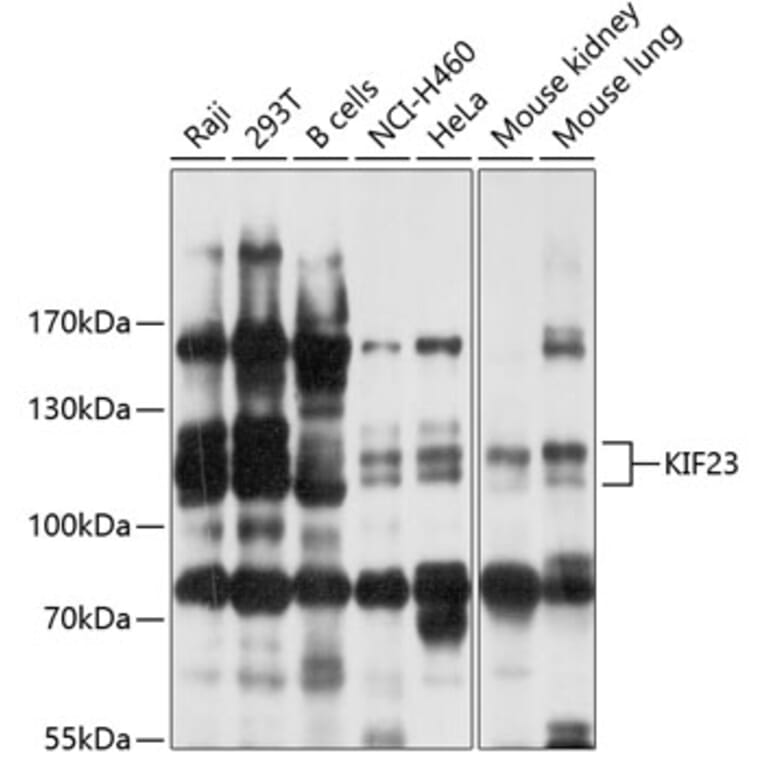 Western Blot - Anti-KIF23 Antibody (A10800) - Antibodies.com