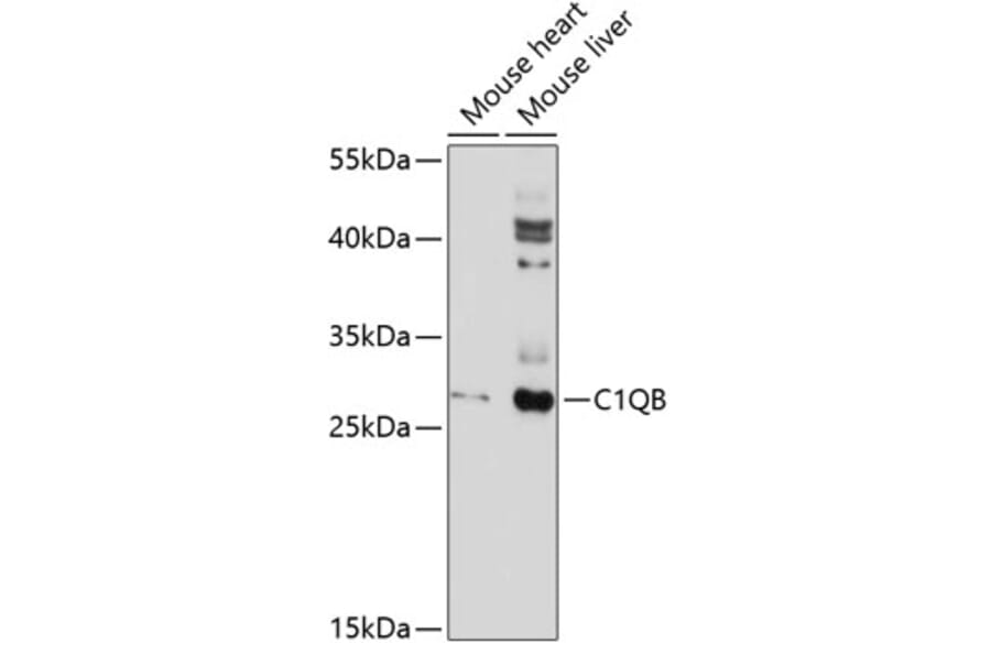 Western Blot - Anti-C1QB Antibody (A10850) - Antibodies.com