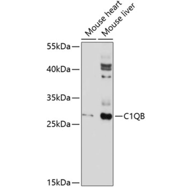 Western Blot - Anti-C1QB Antibody (A10850) - Antibodies.com