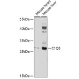 Western Blot - Anti-C1QB Antibody (A10850) - Antibodies.com