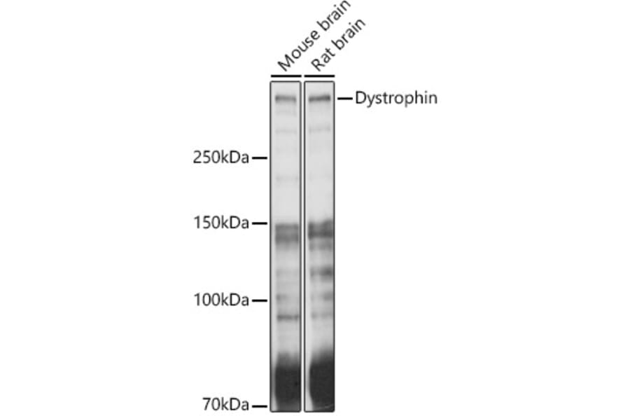 Western Blot - Anti-Dystrophin Antibody (A17013) - Antibodies.com