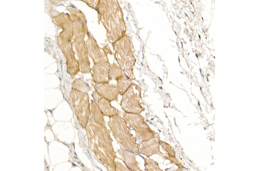 Immunohistochemistry - Anti-Dystrophin Antibody (A17013) - Antibodies.com