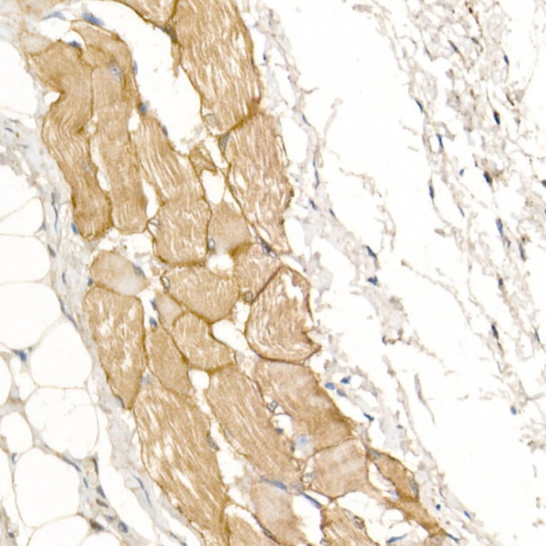 Immunohistochemistry - Anti-Dystrophin Antibody (A17013) - Antibodies.com