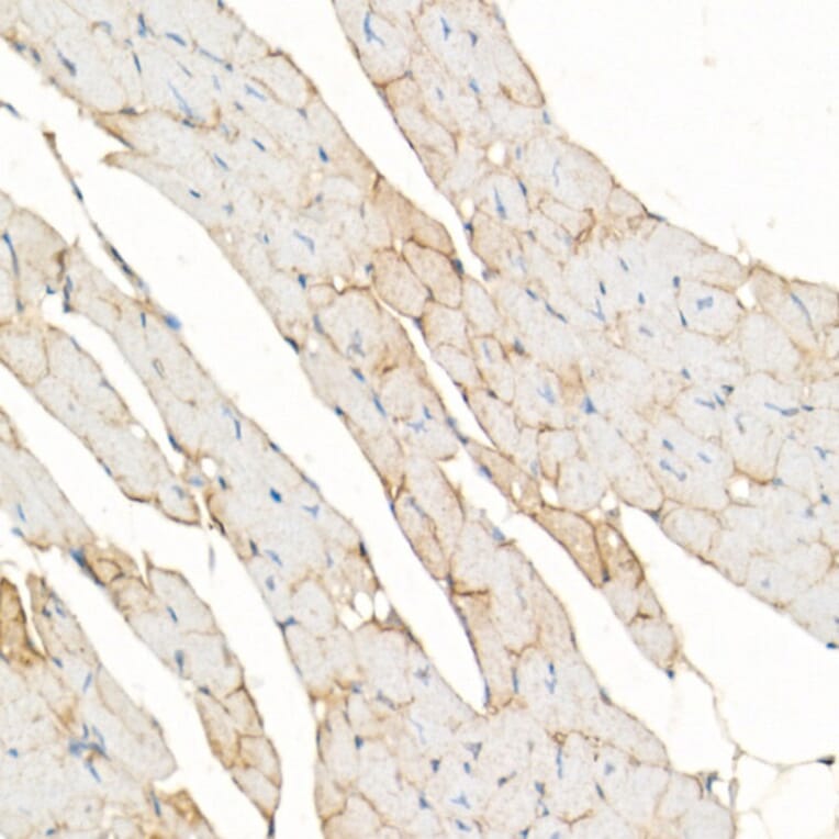 Immunohistochemistry - Anti-Dystrophin Antibody (A17013) - Antibodies.com