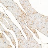 Immunohistochemistry - Anti-Dystrophin Antibody (A17013) - Antibodies.com