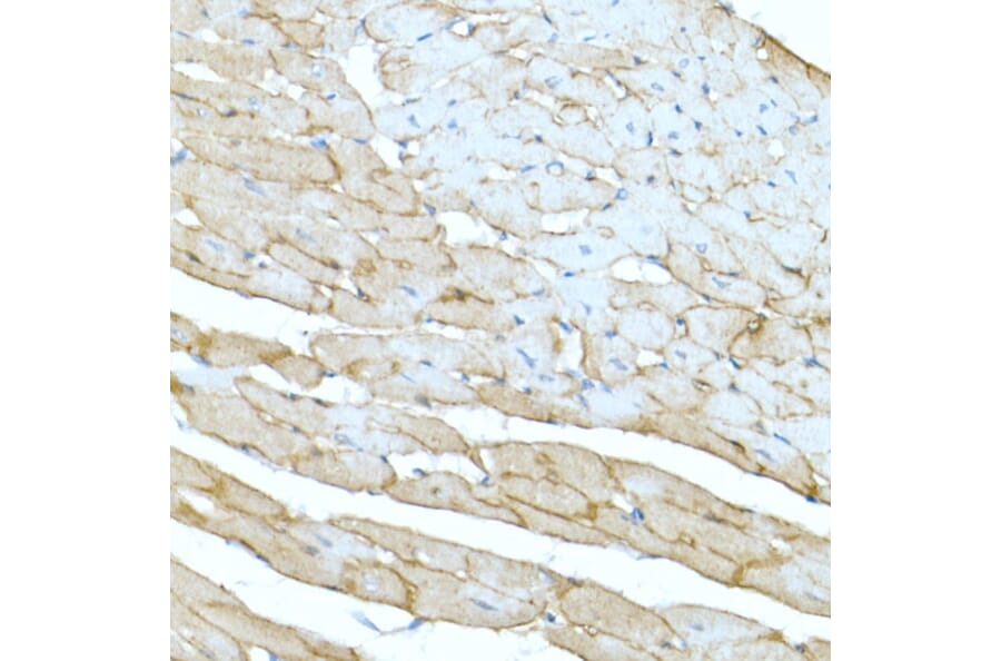 Immunohistochemistry - Anti-Dystrophin Antibody (A17013) - Antibodies.com