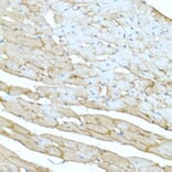 Immunohistochemistry - Anti-Dystrophin Antibody (A17013) - Antibodies.com