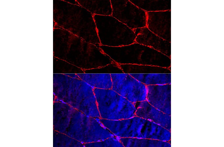 Immunofluorescence - Anti-Dystrophin Antibody (A17013) - Antibodies.com
