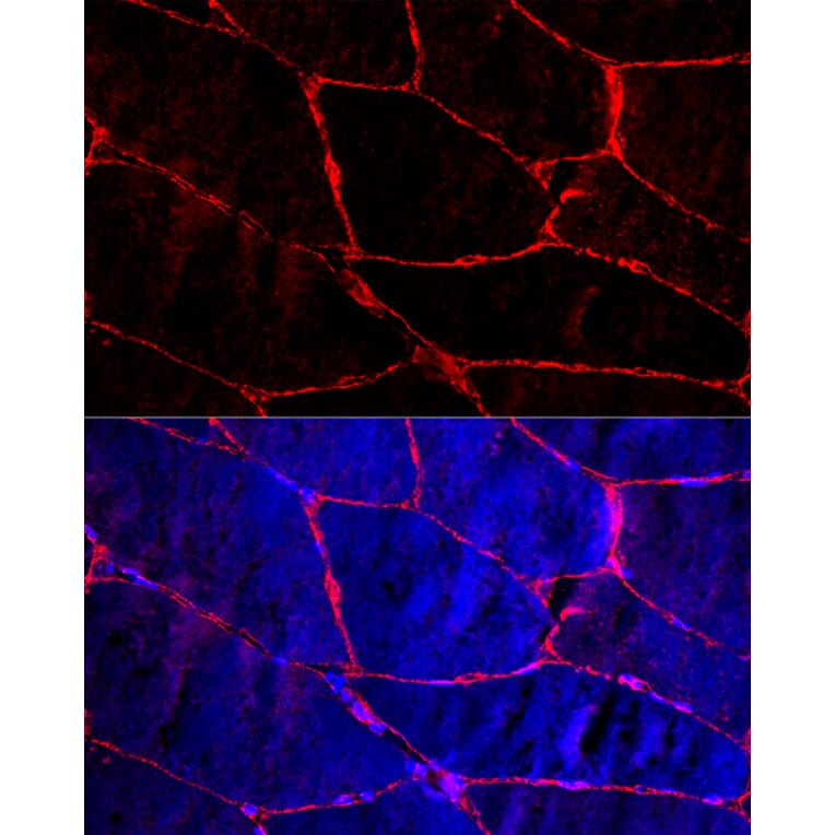 Immunofluorescence - Anti-Dystrophin Antibody (A17013) - Antibodies.com