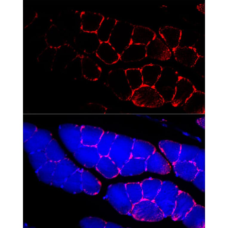 Immunofluorescence - Anti-Dystrophin Antibody (A17013) - Antibodies.com