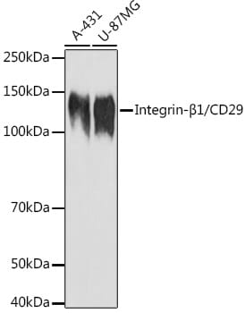 Anti-ITGB1 Antibody (A17015) | Antibodies.com