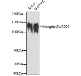 Western Blot - Anti-Integrin beta 1 Antibody (A17015) - Antibodies.com