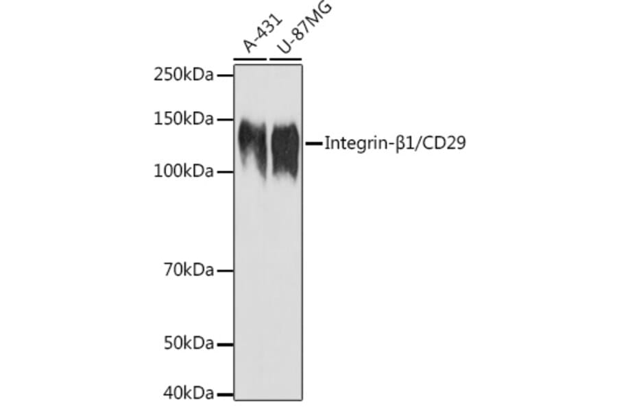 Western Blot - Anti-Integrin beta 1 Antibody (A17015) - Antibodies.com