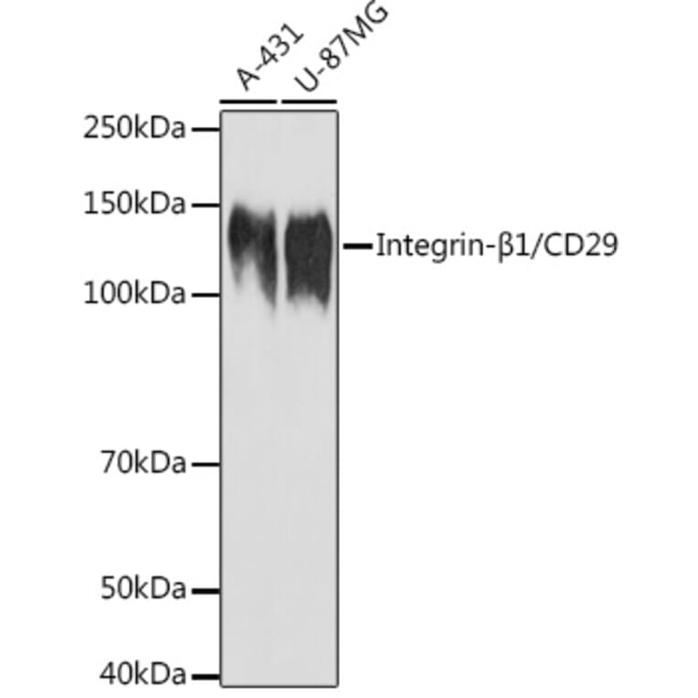 Western Blot - Anti-Integrin beta 1 Antibody (A17015) - Antibodies.com