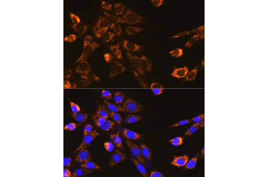 Immunofluorescence - Anti-Integrin beta 1 Antibody (A17015) - Antibodies.com
