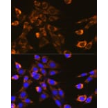 Immunofluorescence - Anti-Integrin beta 1 Antibody (A17015) - Antibodies.com