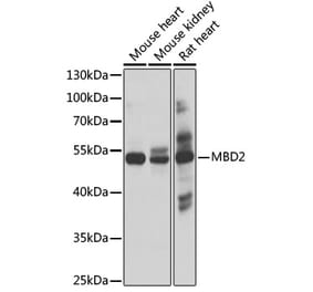 Western Blot - Anti-MBD2 Antibody (A17017) - Antibodies.com