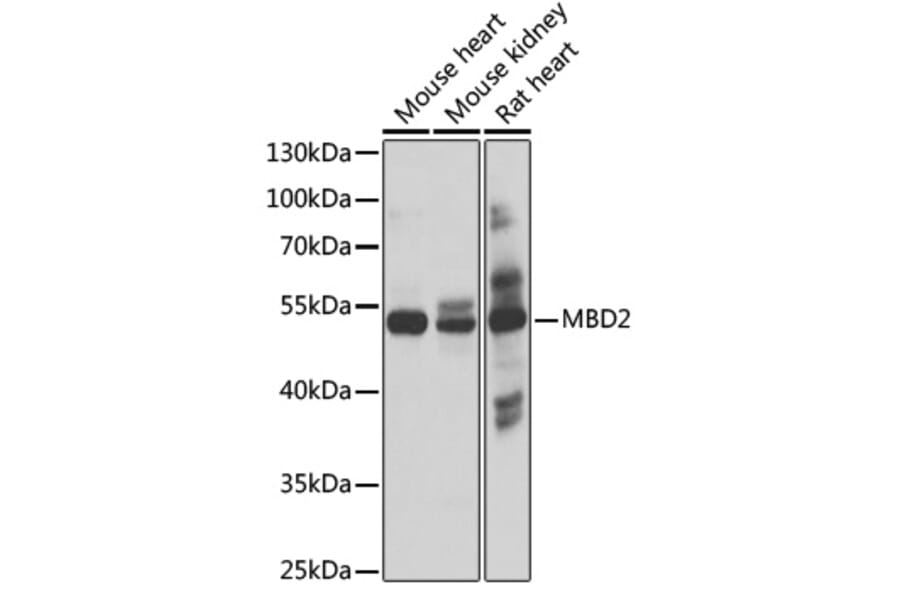 Western Blot - Anti-MBD2 Antibody (A17017) - Antibodies.com
