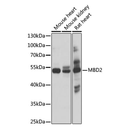 Western Blot - Anti-MBD2 Antibody (A17017) - Antibodies.com