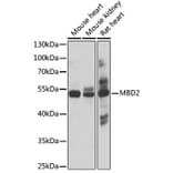 Western Blot - Anti-MBD2 Antibody (A17017) - Antibodies.com