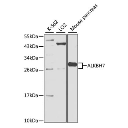 Western Blot - Anti-ALKBH7 Antibody (A17018) - Antibodies.com