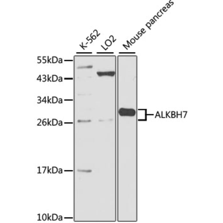 Western Blot - Anti-ALKBH7 Antibody (A17018) - Antibodies.com