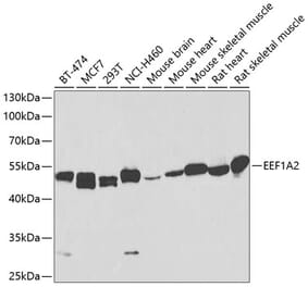 Western Blot - Anti-EEF1A2 Antibody (A17020) - Antibodies.com