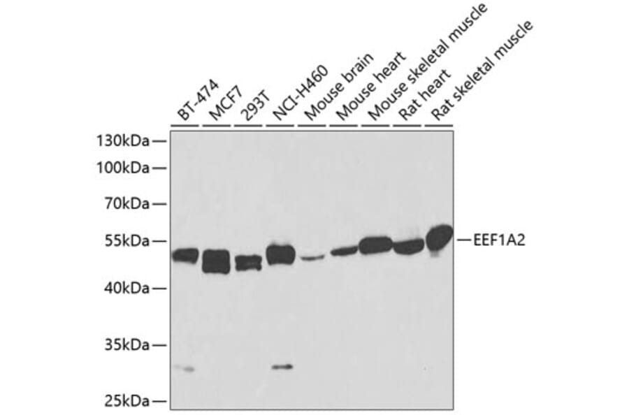 Western Blot - Anti-EEF1A2 Antibody (A17020) - Antibodies.com