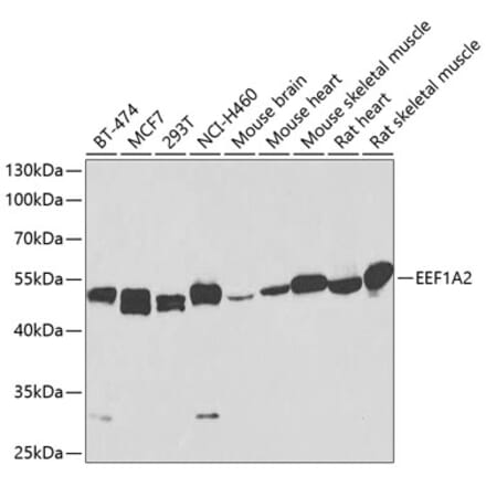 Western Blot - Anti-EEF1A2 Antibody (A17020) - Antibodies.com