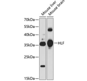 Western Blot - Anti-HLF Antibody (A17022) - Antibodies.com