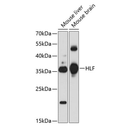 Western Blot - Anti-HLF Antibody (A17022) - Antibodies.com