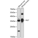 Western Blot - Anti-HLF Antibody (A17022) - Antibodies.com
