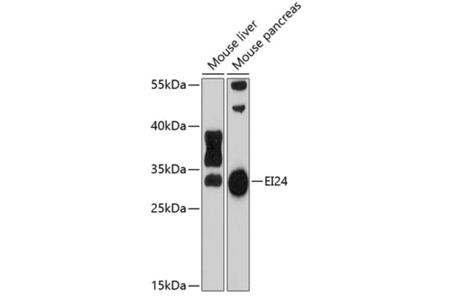 Western Blot - Anti-EI24 Antibody (A3228) - Antibodies.com