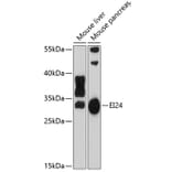 Western Blot - Anti-EI24 Antibody (A3228) - Antibodies.com