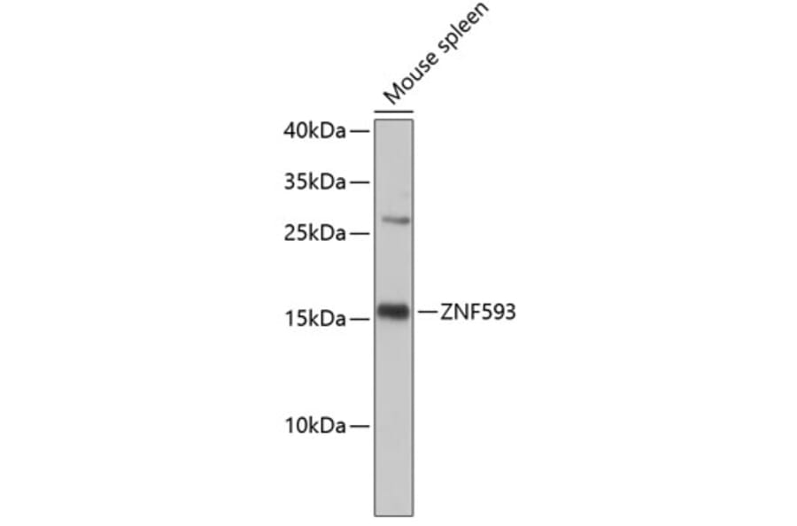 Western Blot - Anti-ZNF593 Antibody (A3428) - Antibodies.com