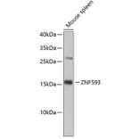 Western Blot - Anti-ZNF593 Antibody (A3428) - Antibodies.com