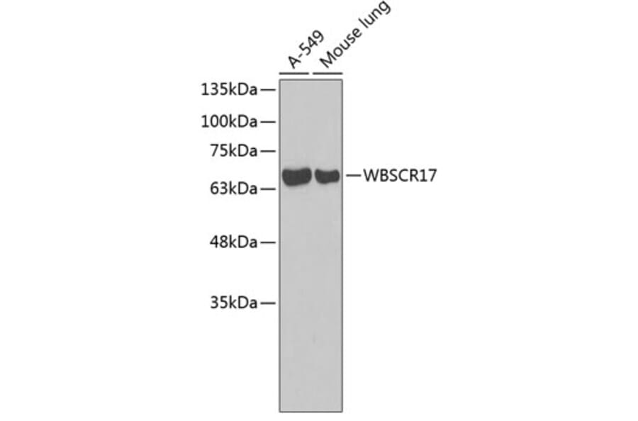 Western Blot - Anti-WBSCR17 Antibody (A3481) - Antibodies.com