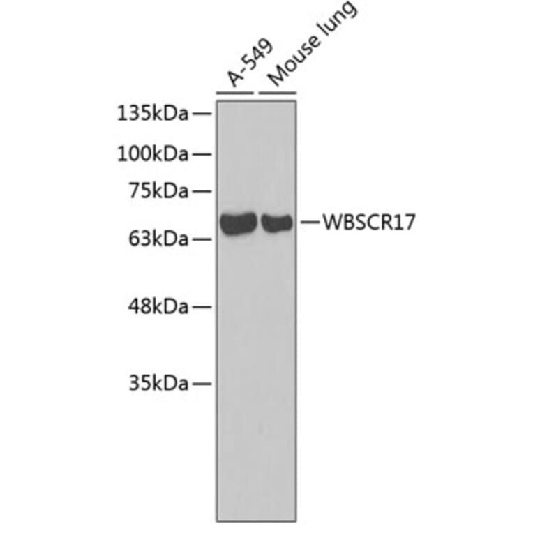 Western Blot - Anti-WBSCR17 Antibody (A3481) - Antibodies.com
