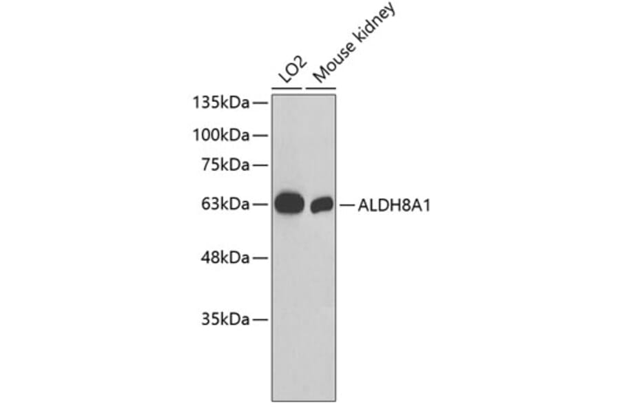 Western Blot - Anti-ALDH8A1 Antibody (A3482) - Antibodies.com