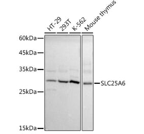 Western Blot - Anti-SLC25A6 Antibody (A17030) - Antibodies.com