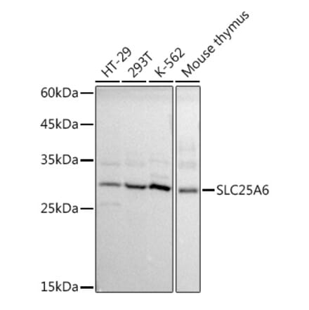 Western Blot - Anti-SLC25A6 Antibody (A17030) - Antibodies.com