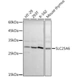 Western Blot - Anti-SLC25A6 Antibody (A17030) - Antibodies.com