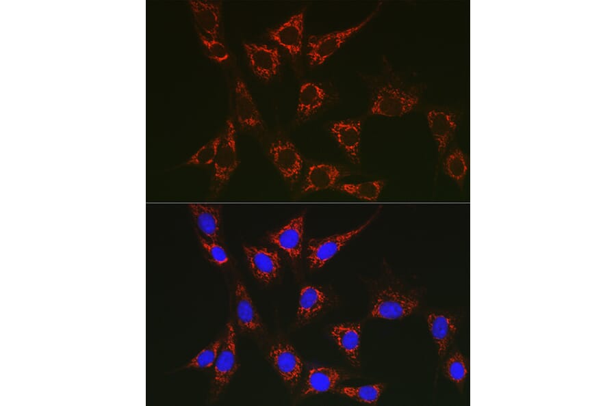 Immunofluorescence - Anti-SLC25A6 Antibody (A17030) - Antibodies.com
