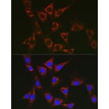 Immunofluorescence - Anti-SLC25A6 Antibody (A17030) - Antibodies.com