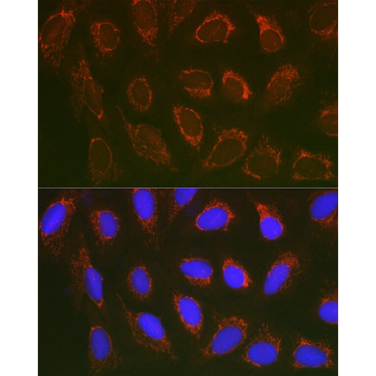 Immunofluorescence - Anti-SLC25A6 Antibody (A17030) - Antibodies.com