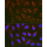 Immunofluorescence - Anti-SLC25A6 Antibody (A17030) - Antibodies.com