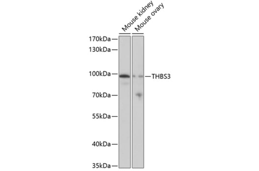 Western Blot - Anti-THBS3 Antibody (A17032) - Antibodies.com