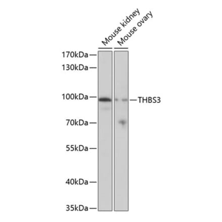Western Blot - Anti-THBS3 Antibody (A17032) - Antibodies.com