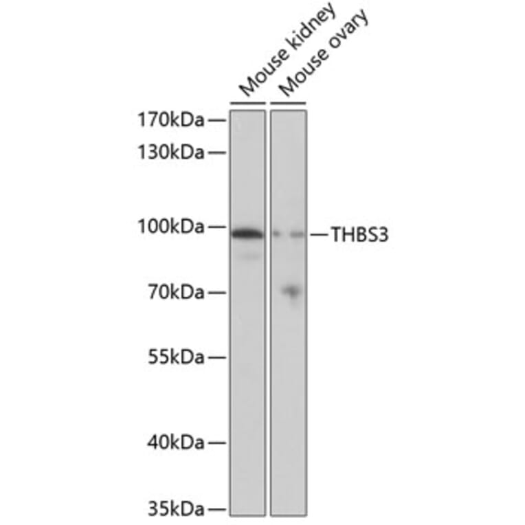 Western Blot - Anti-THBS3 Antibody (A17032) - Antibodies.com