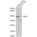 Western Blot - Anti-THBS3 Antibody (A17032) - Antibodies.com
